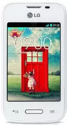 Galleria Foto LG L35